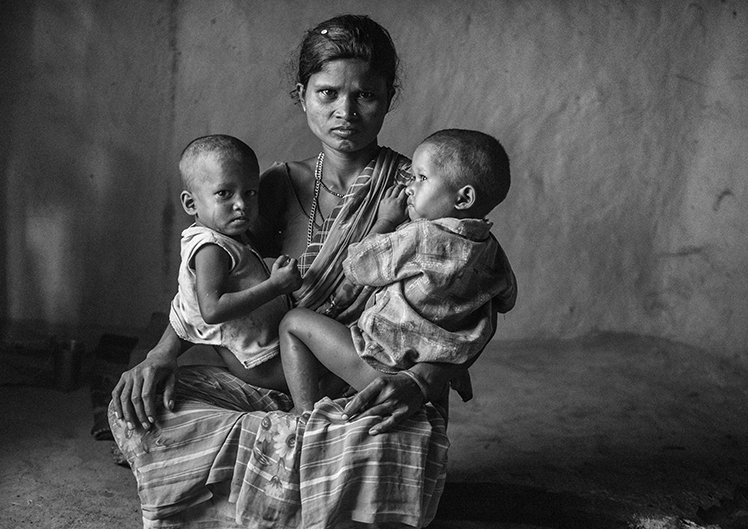 ENDANGERED SPECIES: MALNUTRITION STALKS INDIA’S CHILDREN